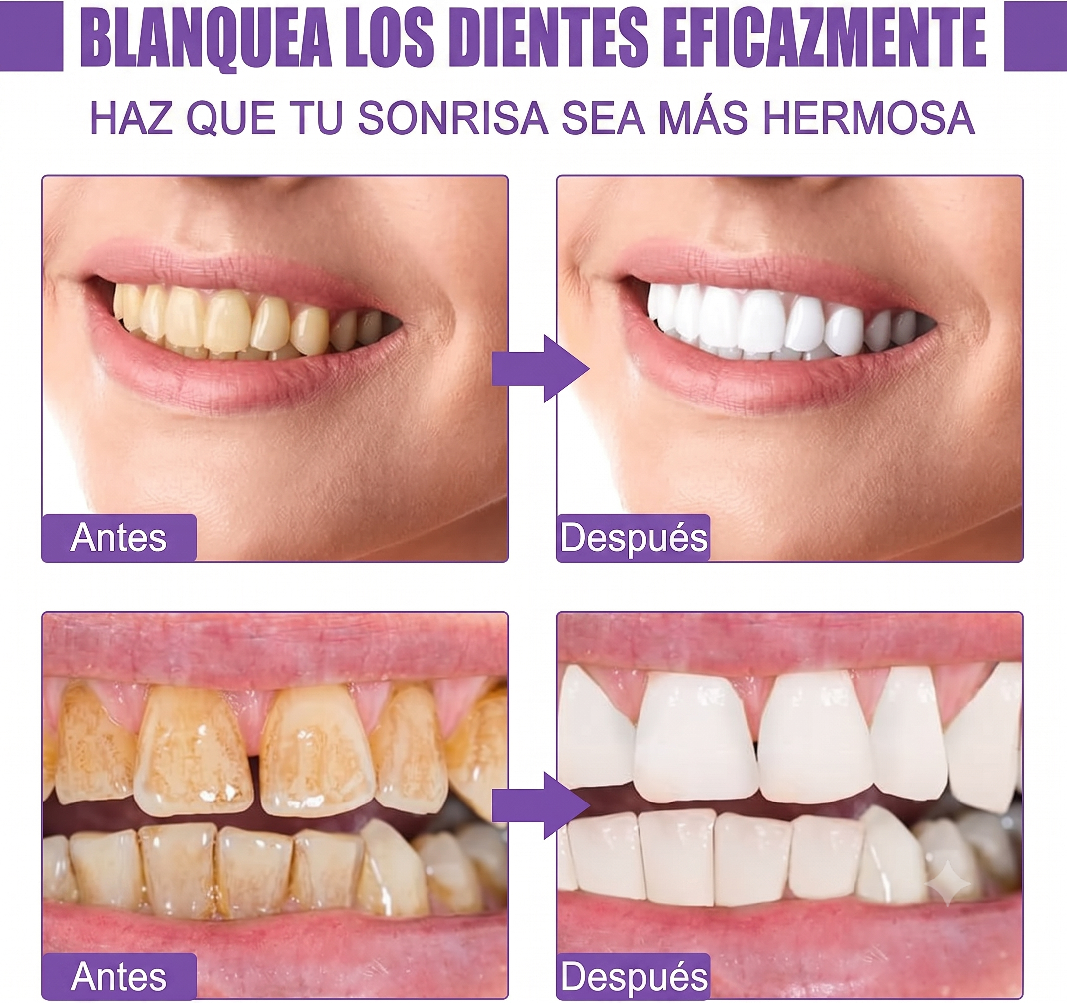 Corrector Y Blanqueador Oxiprime Super White V34 80ml