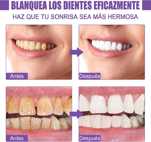 Corrector Y Blanqueador Oxiprime Super White V34 80ml